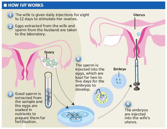 Intrauterine insemination in Andhra Pradesh,iui treatments in Andhra Pradesh,Intrauterine insemination treatments in Andhra Pradesh,Best Fertility Hospital In Andhra Pradesh,Best IVF Doctors In Andhra Pradesh,Best IVF centers In Andhra Pradesh,In Vitro Fertilization treatments in Andhra Pradesh,ivf treatments in Andhra Pradesh,ivf treatment in Andhra Pradesh,fertilization hospitals in Andhra Pradesh,In Vitro Fertilization, IVF Treatment in Andhra Pradesh,Best Infertility centers in Andhra Pradesh,Best Center for Human Reproduction,IVF and Reproductive Medicine,Fertility and Reproductive Medicine,ICSI and IVF for Male Infertility hospitals in Andhra Pradesh,Intracytoplasmic sperm injection treatments in Andhra Pradesh,ICSI Infertility Treatment in Andhra Pradesh,ICSI Treatment centers in Andhra Pradesh,gynaecology hospitals in Andhra Pradesh,gynaecology specialists in Andhra Pradesh,best gynaecology hospitals in Andhra Pradesh,obstetrics and gynaecology hospitals in Andhra Pradesh,Best obstetrics and gynaecology doctors in Andhra Pradesh,Vaginal Infections specialist in Andhra Pradesh,Pelvic Masses or Pelvic Tumor Treatment in Andhra Pradesh,gynaecology treatments in Andhra Pradesh,gynaecologist doctors in Andhra Pradesh,best Gynaecologist in Andhra Pradesh,Uterine Bleeding treatments in Andhra Pradesh,Best obstetric specialist in Andhra Pradesh,High pregnancy risk specialists in Andhra Pradesh,Polycystic Ovarian Disease treatments in Andhra Pradesh,Prenatal and Antepartum Care in Andhra Pradesh,Best Gynaecology Cesarean in Andhra Pradesh,Care for Pregnancy on Diabetes in Andhra Pradesh,Hypertension, pre-eclampsia and eclampsia treatments in Andhra Pradesh,Premature Rupture treatments in Andhra Pradesh,Post-term pregnancy care in Andhra Pradesh